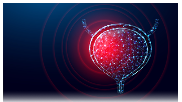 Beyond Platinum: Current Approaches to Advanced Bladder Cancer