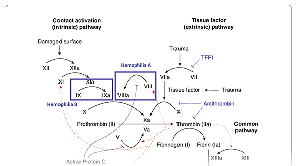 Fitusiran in Hemophilia: A Novel Therapeutic Approach Targeting Antithrombin